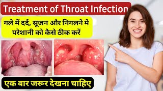 Pharyngitis throat infection treatment in hindi  गले में खराश दर्द और सूजन होने पर क्या करें [upl. by Ailak999]