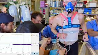 Cardiac Output measurement using thermodilution [upl. by Arhsub994]