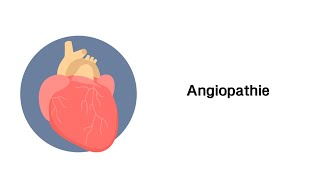 Angiopathie Mikroangiopathie  Makroangiopathie  Erkrankungen der Gefäße mit Infoleiste [upl. by Ramon]