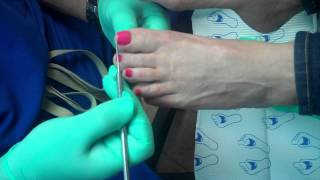 The proper way to trim your toenails [upl. by Nicky]