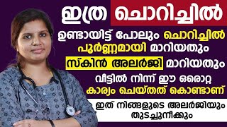 ഏത് കഠിനമായ ചൊറിച്ചിലും സ്കിൻ അലർജിയും പൂർണമായി മാറ്റിയെടുക്കാം  skin allergy malayalam [upl. by Farant822]