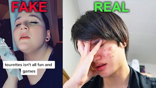 Guy with Real Tourettes Reacts to Tiktoker Faking Tourettes [upl. by Aennaej574]