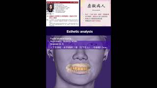 Virtual patient esthetic analysis [upl. by Ginny]