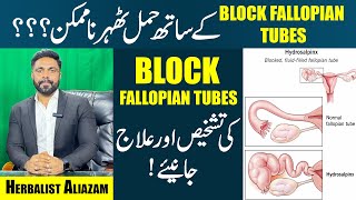 Fallopian Tubes Blockage  Causes amp Symptoms  Get Pregnant With Blocked Tubes  EhtishamJanjua [upl. by Daitzman282]