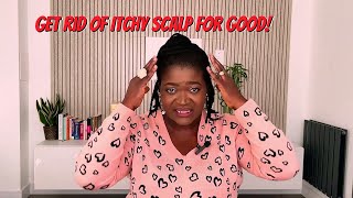 The fastest way to get rid of itchy scalp for good Tips and Tricks [upl. by Cash]