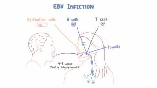 EBV and Mononucleosis  Pathogenesis and Clinical Presentation [upl. by Eicarg]