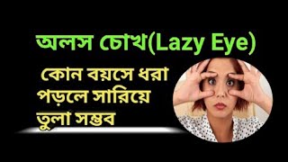 AmblyopiaLazy Eye কি Types Treatment [upl. by Bunnie]