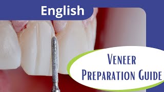 Veneer preparation guide [upl. by Esyahc]