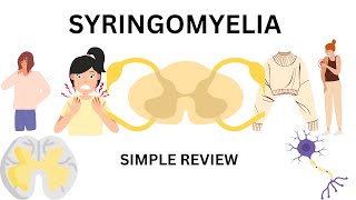 syringomyelia  featurescauses and treatment [upl. by Hodgson373]