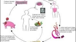 First case of living adult Taenia Solium body found within human brain tissue graphic [upl. by Maag389]