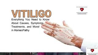 Vitiligo phulbehri  Causes Symptoms and Treatment in Homeopathy  Dr Vandana Gulati [upl. by Bourke829]