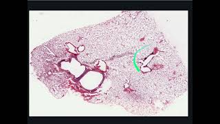 Respiratory System Histology  Lung Introduction [upl. by Lose607]