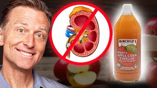 Use Apple Cider Vinegar to Dissolve Kidney Stones [upl. by Drida376]