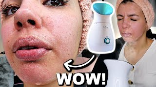 How to properly steam your face at home to remove dirt and unclog pores For Oily Skin [upl. by Purity]