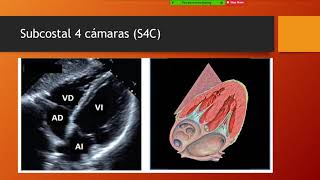 Ecocardiograma Normal [upl. by Atsok439]