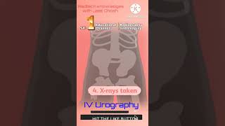 IV Urography radiology xray radiography mbbsstudent shorts [upl. by Darmit3]