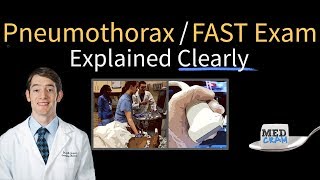 Pneumothorax on Ultrasound  FAST Exam Explained Clearly [upl. by Aivan]