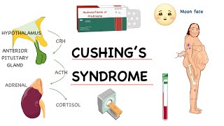 ‎⭕ شرح مفصل خطوة بخطوة لـ  Pathophysiology of Cushing’s Syndrome [upl. by Nya870]