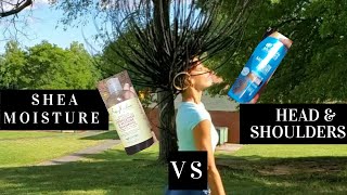 Shea Moisture VS Head and Shoulders for itchydry scalp [upl. by Hgielram]