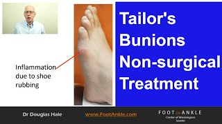 Tailors Bunion Best Practices  Seattle Podiatrist [upl. by Nehgaem]