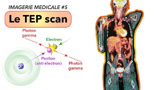 IMAGERIE MEDICALE 5  Le TEP scan [upl. by Cumine411]