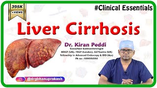 Liver Cirrhosis Clinical essentials  Dr Kiran Peddi MRCPUK FRCPLondon CCTGastro [upl. by Modern]