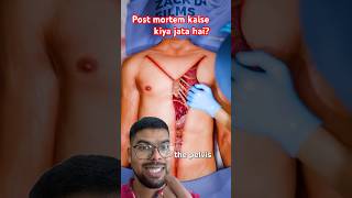 Post mortem kaise hota hai doctor science anatomy facts shorts postmortemreport [upl. by Carbrey]