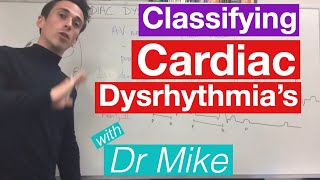 Cardiac dysrhythmias arrhythmias common [upl. by Turley335]