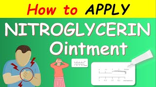 Nitroglycerin ointment  How to apply [upl. by Vigen]