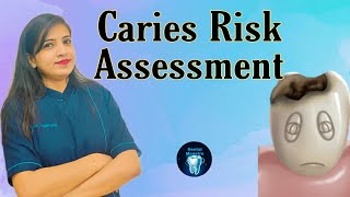 Caries Risk Assessment [upl. by Nylear]