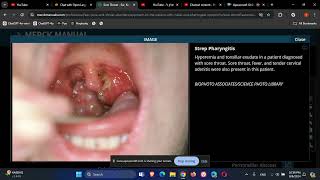 Otolaryngology ENT Sore Throat [upl. by Duong]