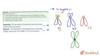 Assertion  The acrocentric chromosome has centromere at the terminal position [upl. by Sire320]