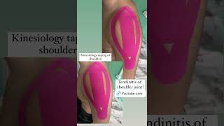 Tendinitis of shoulder joint Kinesiology taping [upl. by Arbed155]