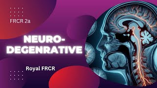 5  Neuroimaging for FRCR [upl. by Hirst]