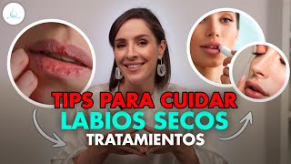 🔴 Adios LABIOS SECOS o AGRIETADOS ten SIEMPRE LABIOS SANOS y SUAVES drapilarochoa  Dermatologa [upl. by Azaria]