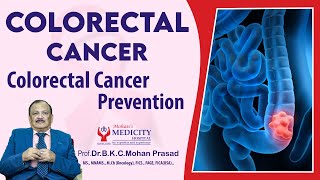 Colon Cancer Symptoms  Colorectal Cancer  Colorectal Cancer Prevention in English [upl. by Adnic]