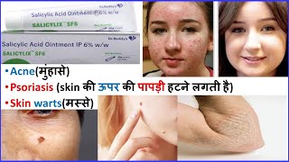 SALICYLIC ACID OINTMENT का यूज कब और कैसे किया जाता हैSALICYLIC ACID CREAM USESPIMPLESACNECREAM [upl. by Johen]