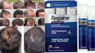 Rogaine Mens Hair Regrowth Treatment Foam [upl. by Limemann]