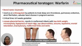 Teratogenesis part 2 [upl. by Hallam]