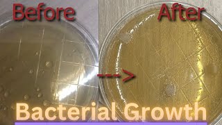 Bacterial Growth Time Lapse Faucet Handle Experiment [upl. by Olemrac]