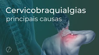 Principais causas das Cervicobraquialgias  dor que irradia do pescoço para o braço [upl. by Akirdnwahs]