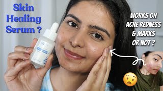 BEST PEPTIDE SKINCARE PRODUCTS 2024 for Oily Dry amp Acne Prone Skin Top Anti Aging Serums amp Creams [upl. by Bower126]