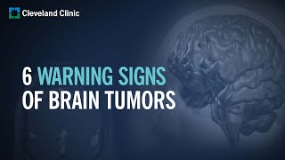 6 Warning Signs of Brain Tumors [upl. by Mariano]