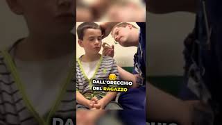 I DOTTORI trovano una PILA nell’orecchio di questo BAMBINO 😱 [upl. by Yenttirb]