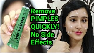 Remove PIMPLES amp ACNE IN 3 DAYS  NATURAL amp EASY METHOD [upl. by Anyal705]