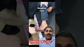 Ganglion cyst [upl. by Suinotna]