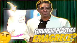 CIRURGIA PLÁSTICA PARA EMAGRECER FUNCIONA TUDO O QUE VOCÊ PRECISA SABER [upl. by Idnis]