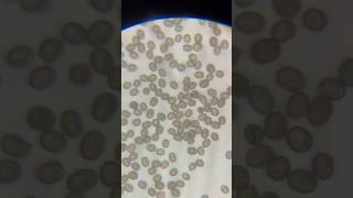 Looking at Mushroom Spores Under a Microscope shorts shortvideo microscope mushroom spore [upl. by Pepita718]