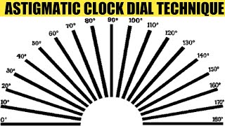 Astigmatic Clock Dial amp Fogging Technique  AK Khurana  Dr Saud Javed [upl. by Gerson]