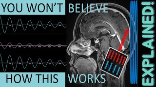 MRI Physics FULLY Explained  MRI Physics Course Lecture 1 [upl. by Ardnekat]